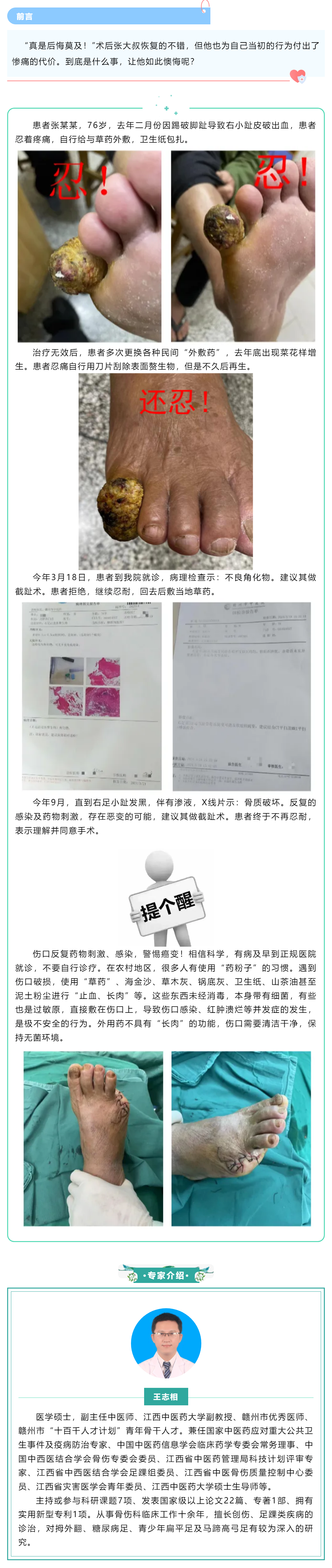 【病案實(shí)錄】小病忍、忍、忍，大病吃苦頭，多么痛的領(lǐng)悟！.png