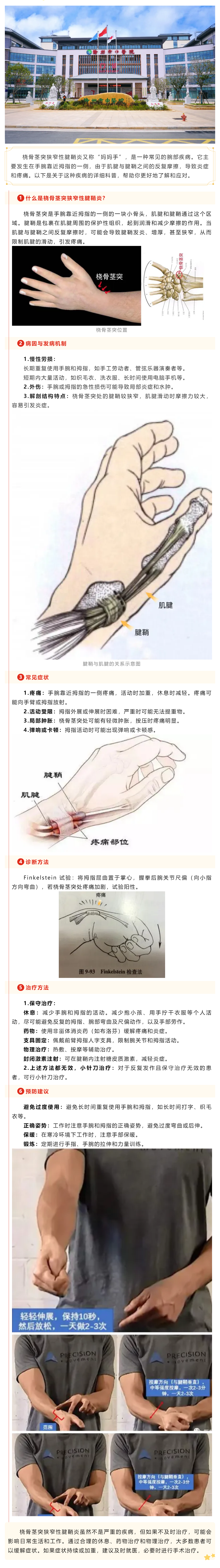 一文讀懂丨橈骨莖突狹窄性腱鞘炎.png
