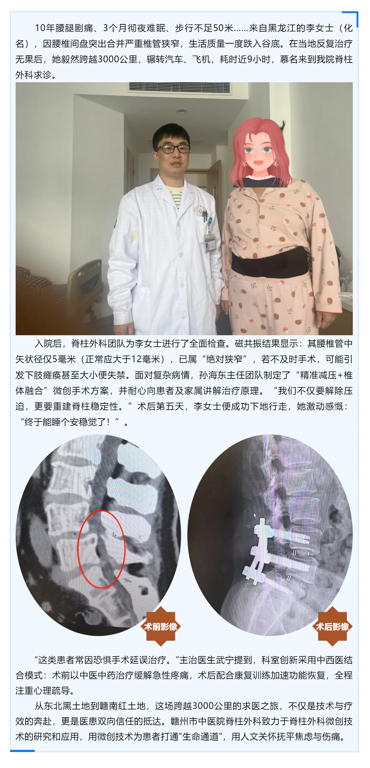 跨越山河的信任_贛州市中醫(yī)院巧手“疏堵”，腰椎狹窄患者3000公里求醫(yī)路終迎新生！.png