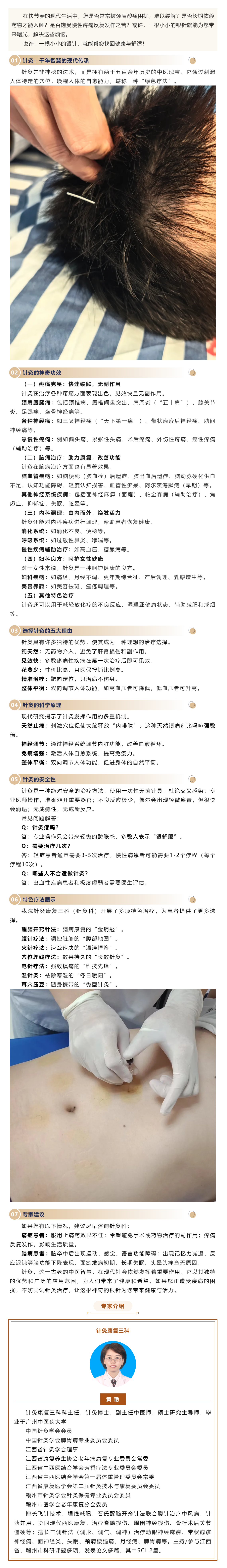 一根銀針，能治這么多病？中醫(yī)針灸的現(xiàn)代妙用.png